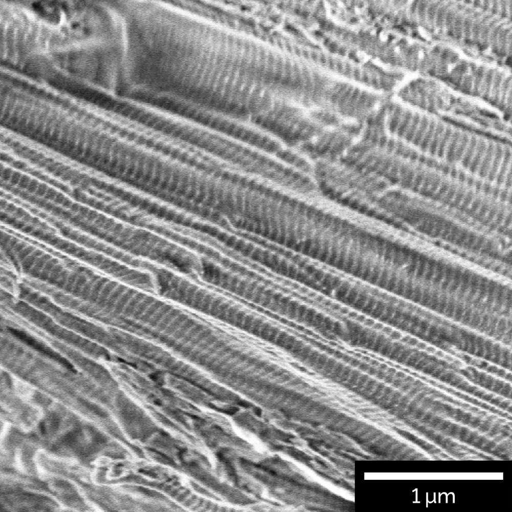 Collagen fibers visualized